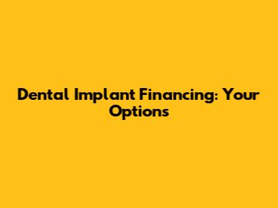 Dental Implant Financing: Your Options